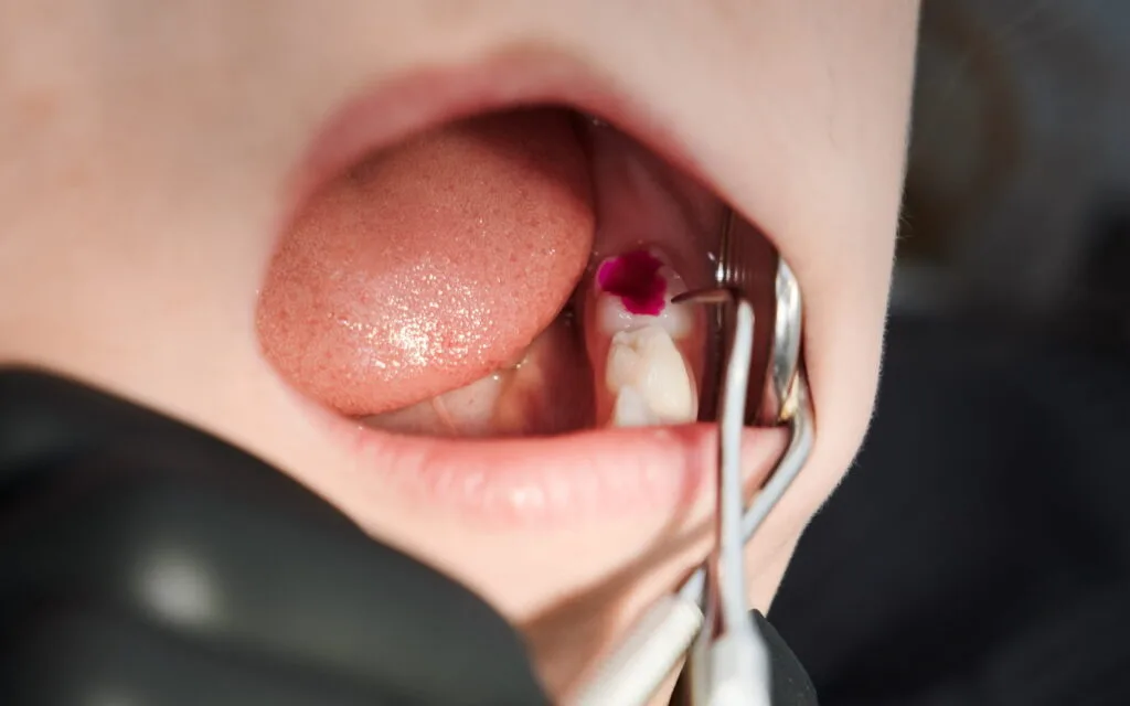 Stomatologist hands examining child teeth dental office scaled e1723164770635 1024x640