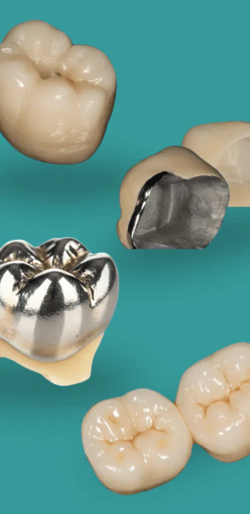 Crowns and Bridge Polidental