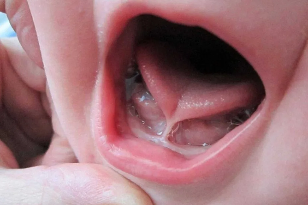 Cover Knowledge Tongue Tie